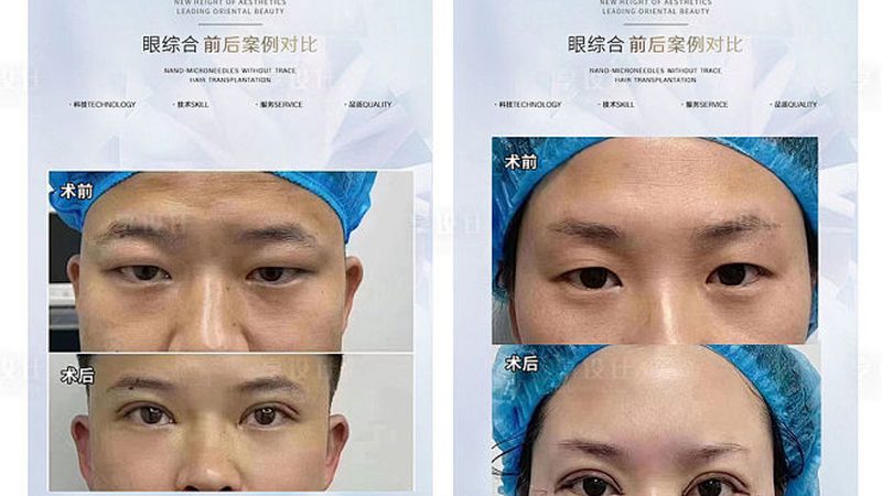 医美咨询师加盟连锁品牌：揭秘加盟背后的行业逻辑