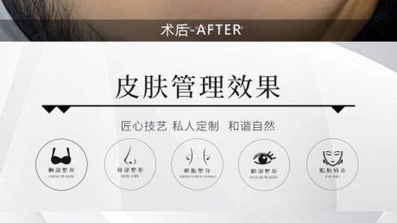 皮肤管理加盟开店，费用明细揭秘