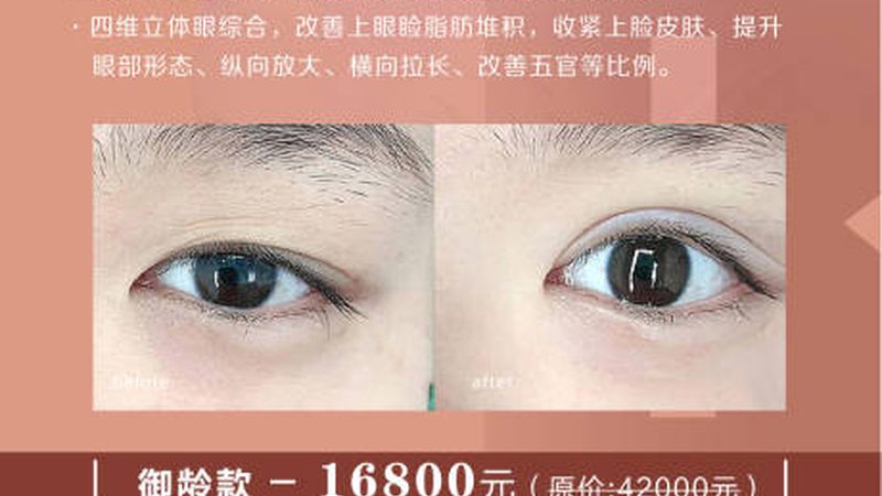 医用瘦脸面膜，如何挑选适合自己的？**