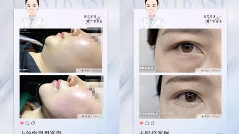 北京海淀区水光针，揭秘其魅力与选择要点