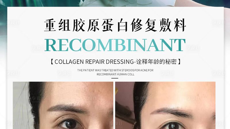 皮肤管理仪器材质与尺寸：揭秘背后的秘密