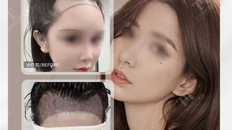 如何甄别隆鼻医院资质？关键步骤与注意事项