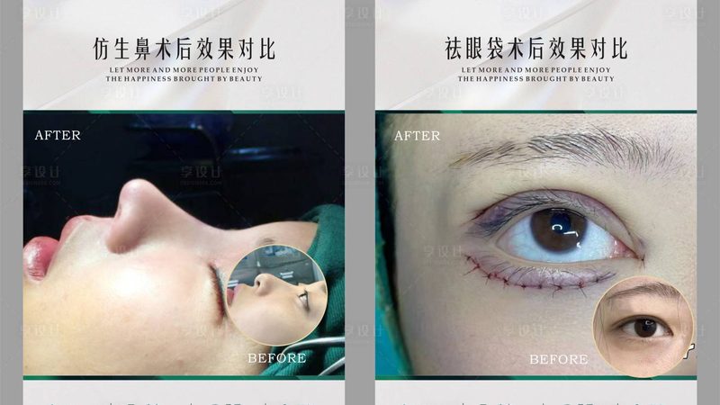 激光祛斑后脸红发烫是正常反应吗