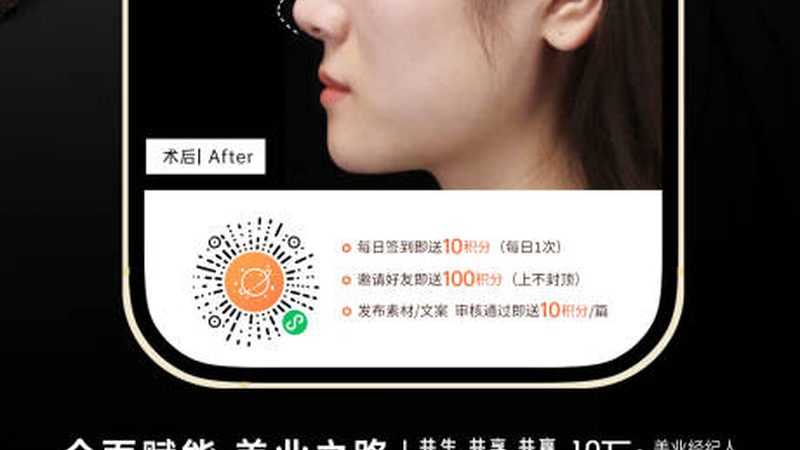 成都激光脱毛前需要做什么准备