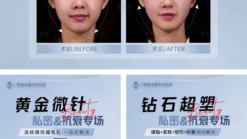 玻尿酸填充面部，价格几何？揭秘玻尿酸填充的秘密**