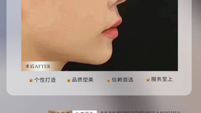 医美咨询师报价表：揭秘如何科学制定
