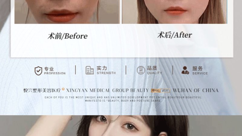 瘦脸精华液加盟代理，你了解其中的“门道”吗？**