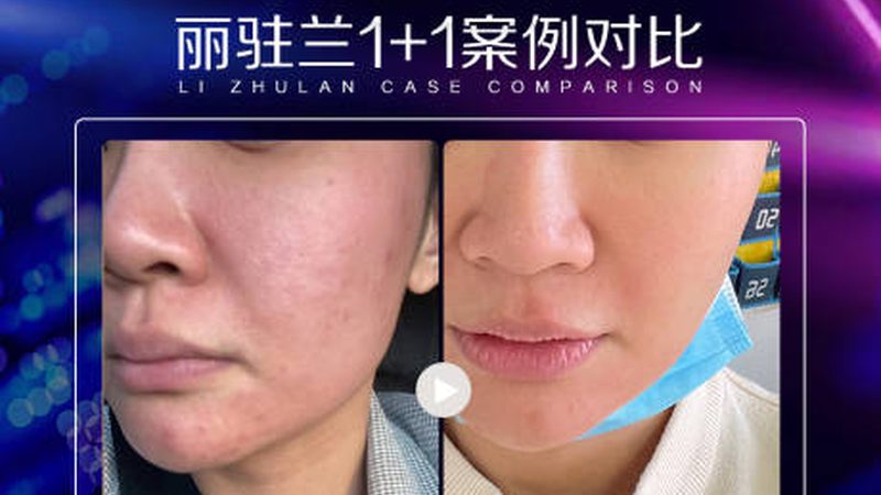 揭秘抗衰面部按摩：手法步骤，轻松掌握