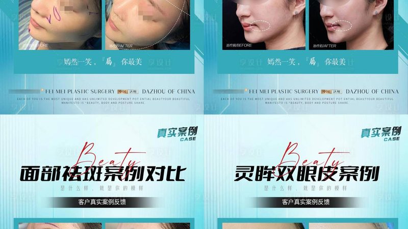埋线提升和热玛吉，到底该先选谁
