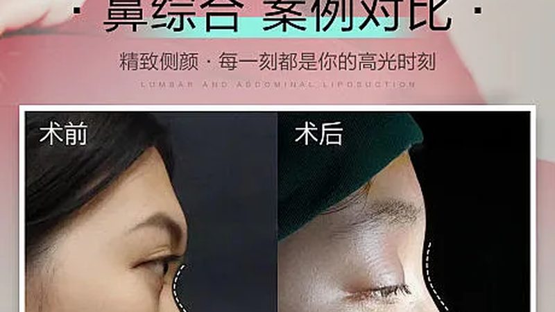 瘦脸面罩，揭秘其使用方法与步骤图解
