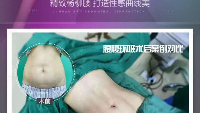 轻医美VS传统医美：揭秘两者差异，助你明智选择