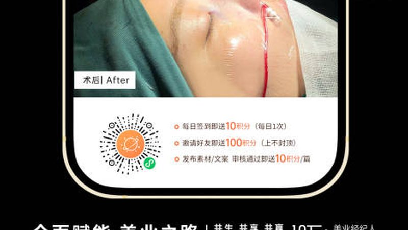 双眼皮修复，费用不只是数字游戏