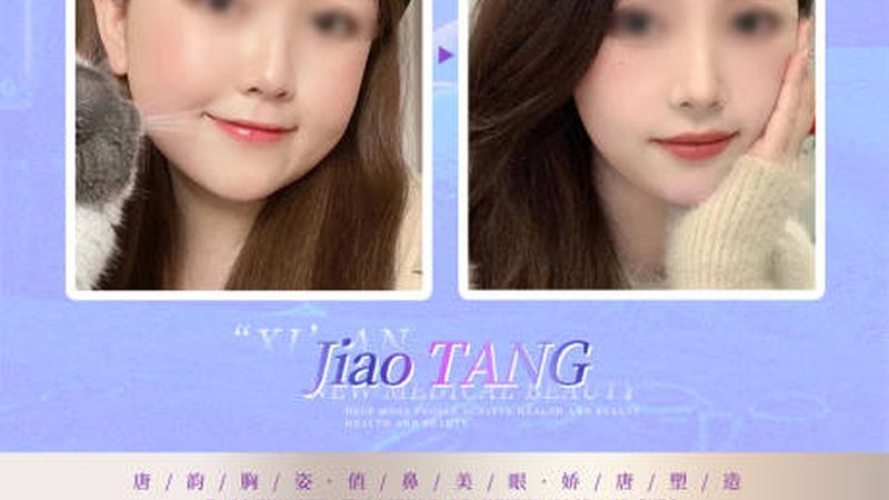 激光祛斑后结痂脱落时间揭秘