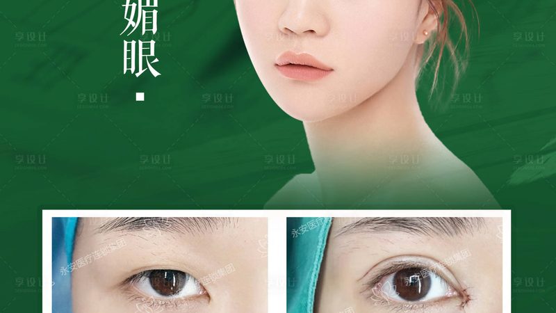 腰腹环吸吸脂，价格之外你该了解的**