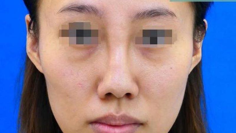 皮肤管理中心与美容院投资成本解析：投资背后的考量因素